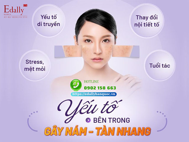 Các yếu tố bên trong gây nám da và tàn nhang ở phụ nữ mang thai