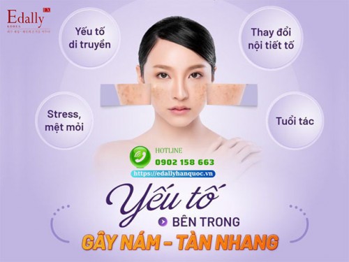 Cách Điều Trị Nám Da Và Tàn Nhang Ở Phụ Nữ Mang Thai