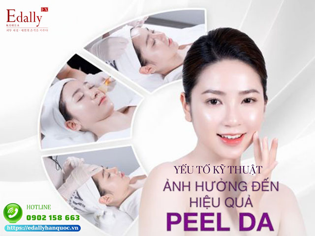 Yếu tố kỹ thuật ảnh hưởng đến hiệu quả peel da